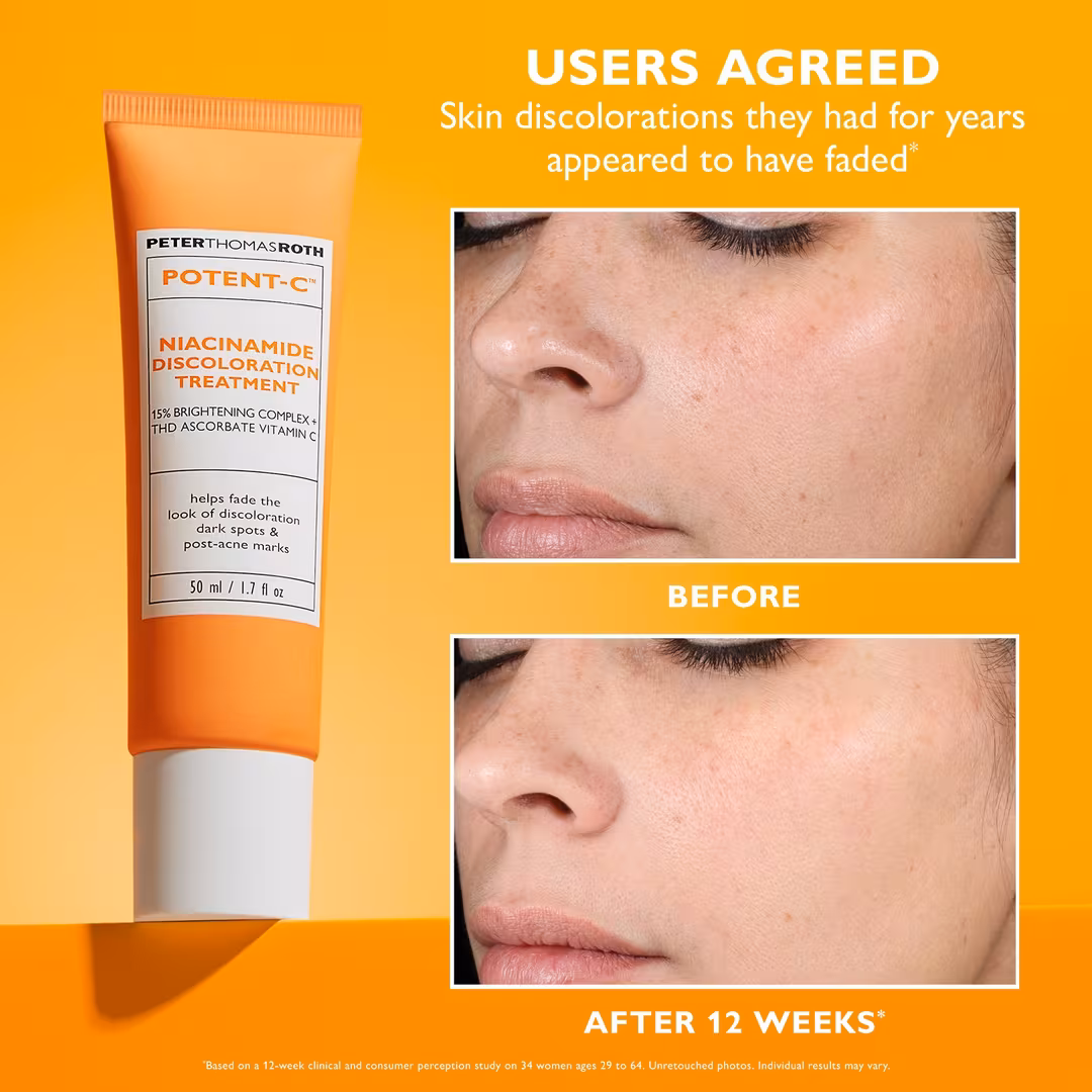 Peter Thomas Roth  Potent-C Niacinamide Discoloration Treatment