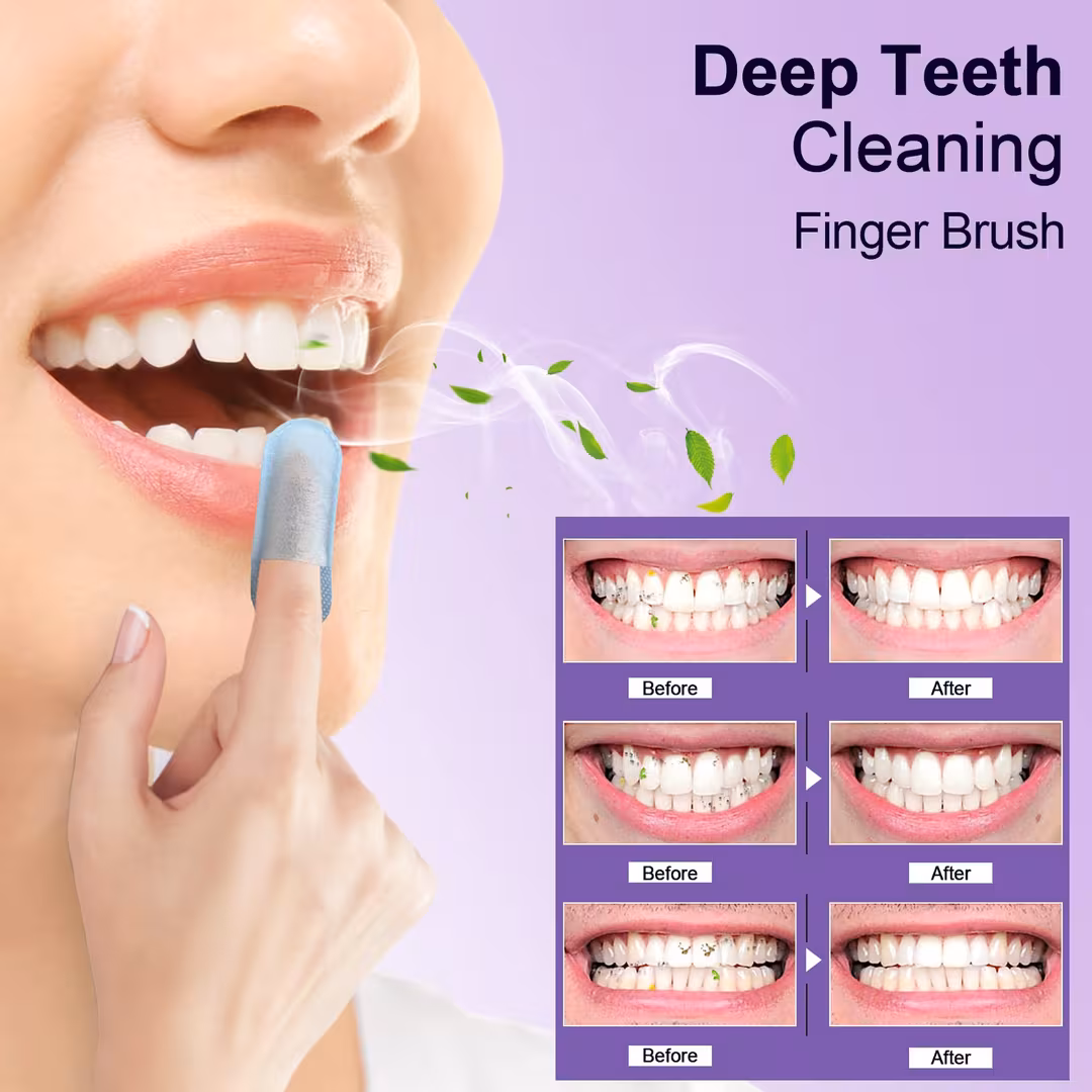 MySmile  Deep Cleaning Teeth Wipes On-the-Go Tooth Cleaner