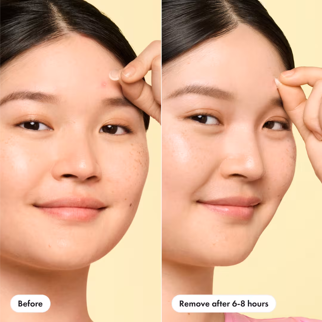 Hero Cosmetics  Mighty Patch Mini Invisible+