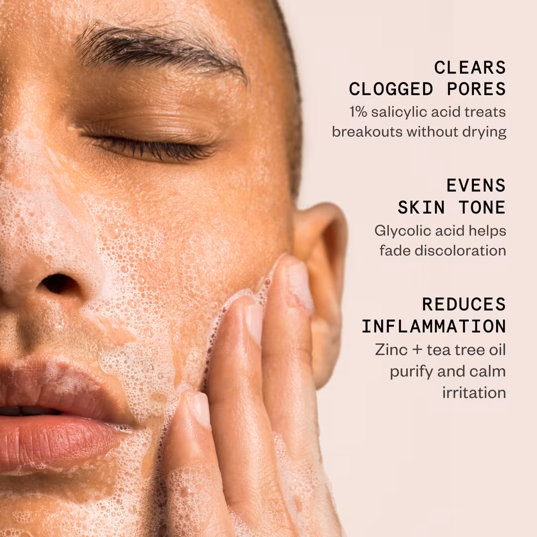 Hypothesis  Daily Acne Cleanser