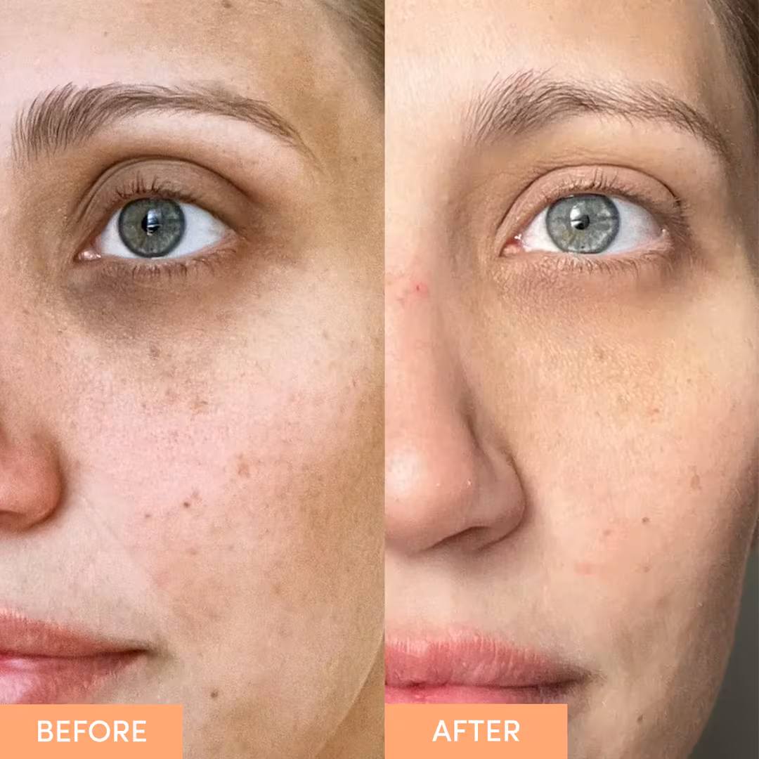 Sand and Sky  Anti-Aging Eye Cream