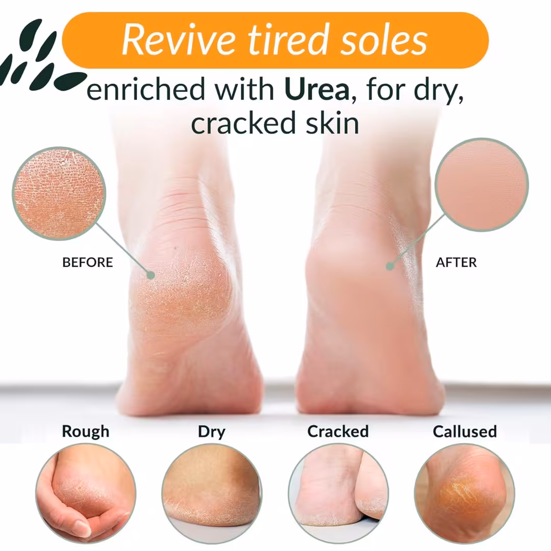 Tree To Tub  Advanced Crack Defense Foot & Heel Moisturizing Cream