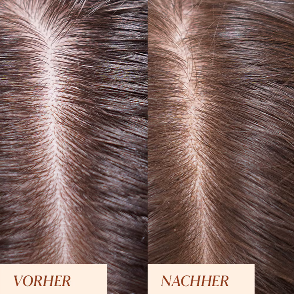 Trockenshampoo