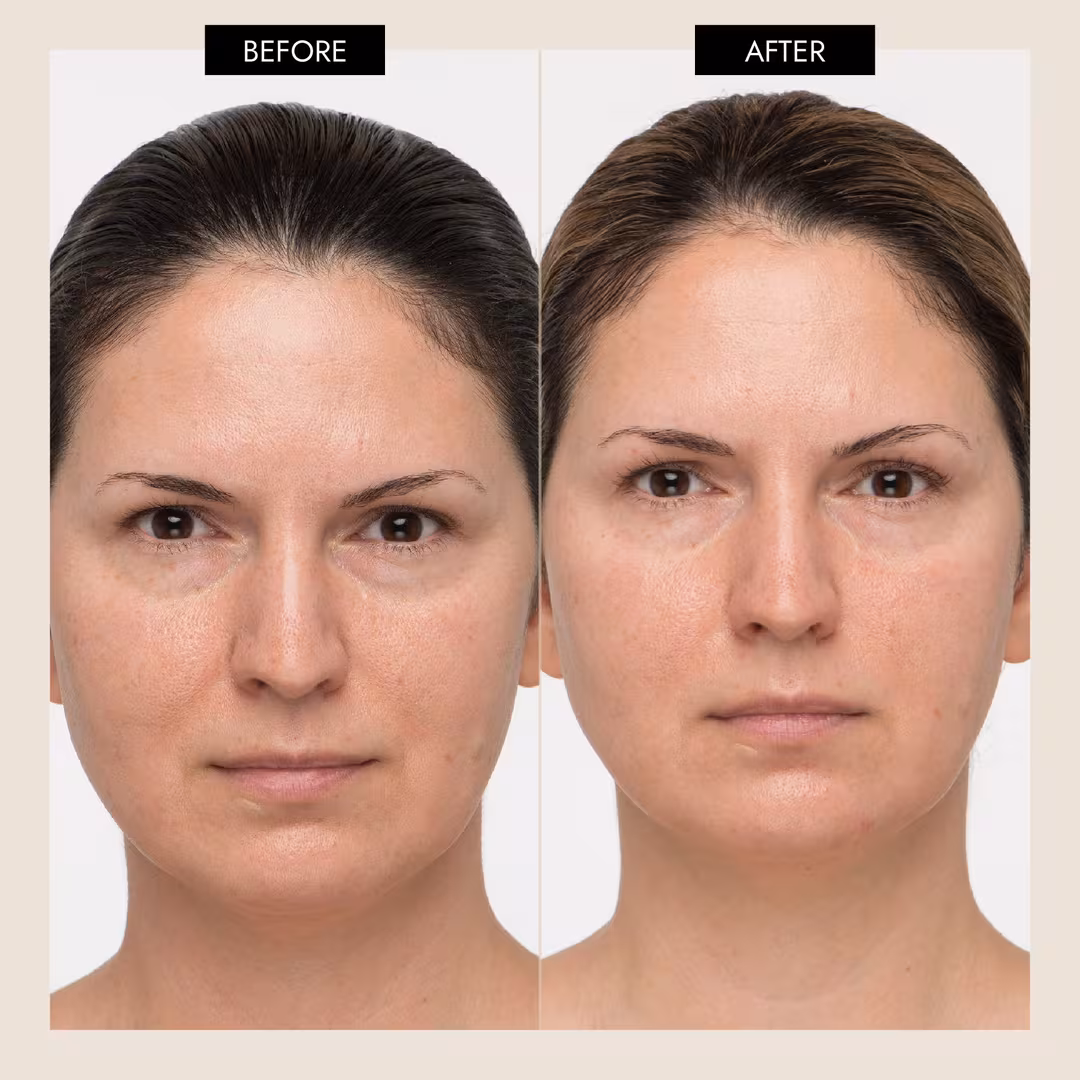 7 E Wellness  Mini Microcurrent Facial Toning Device