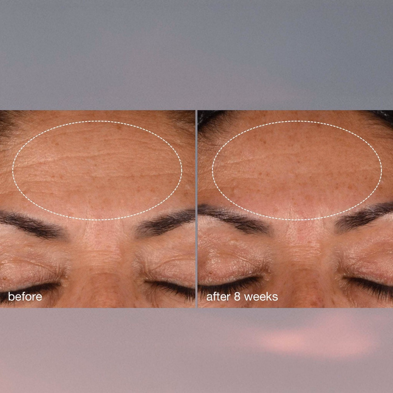 Recovery Cream SPF50