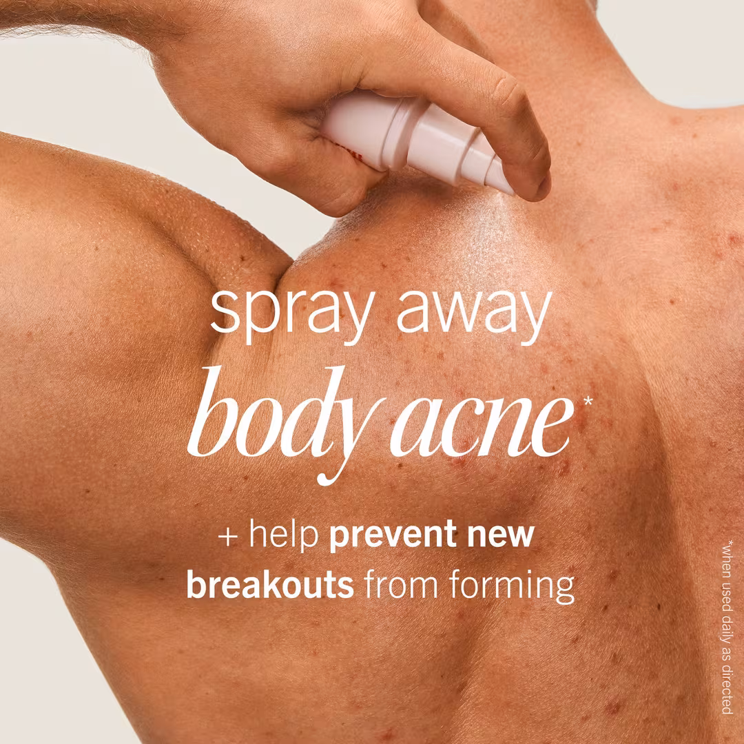 First Aid Beauty  Body Acne Clearing Mist