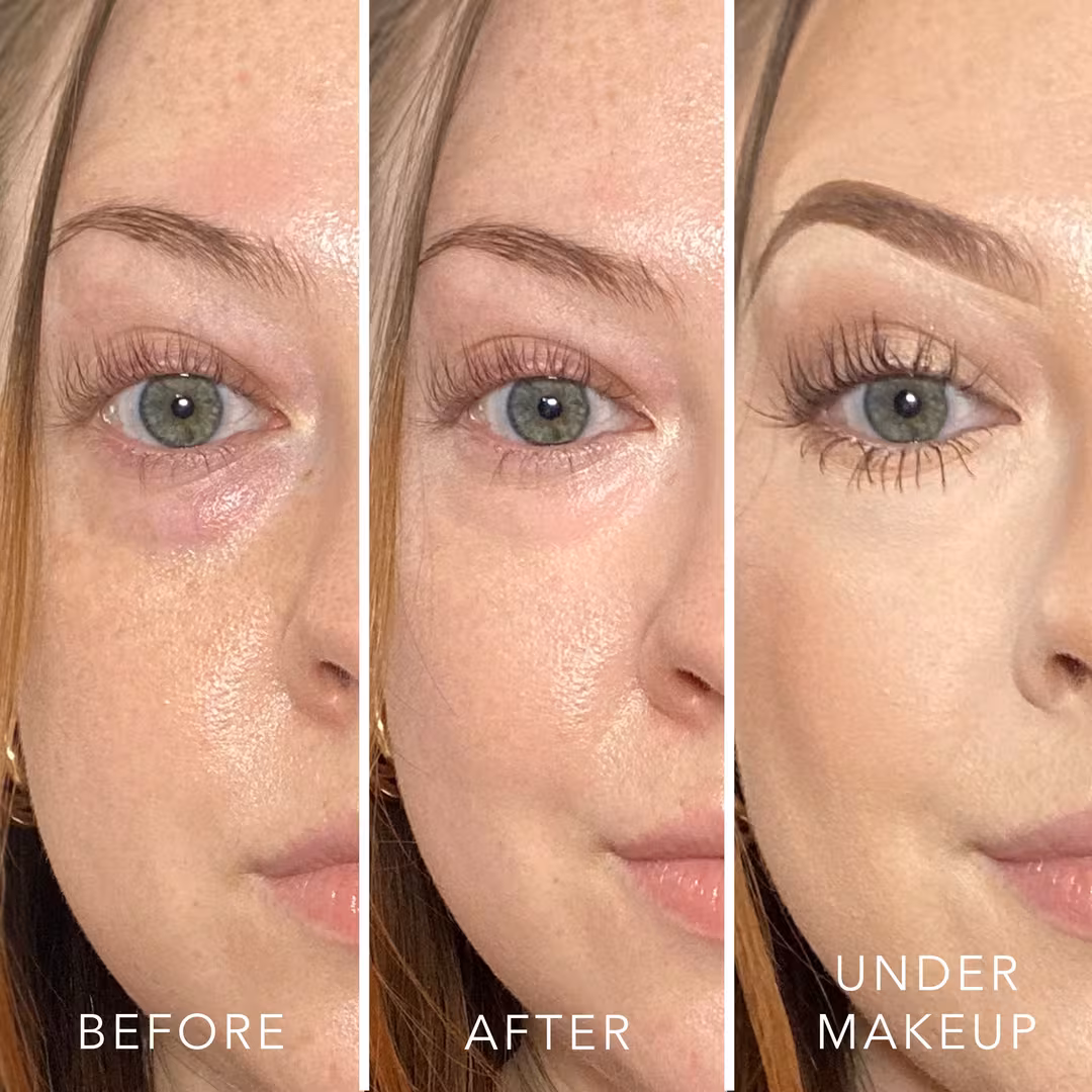 Doll 10  T.C.E This Corrects Everything Luminous Undereye Corrector