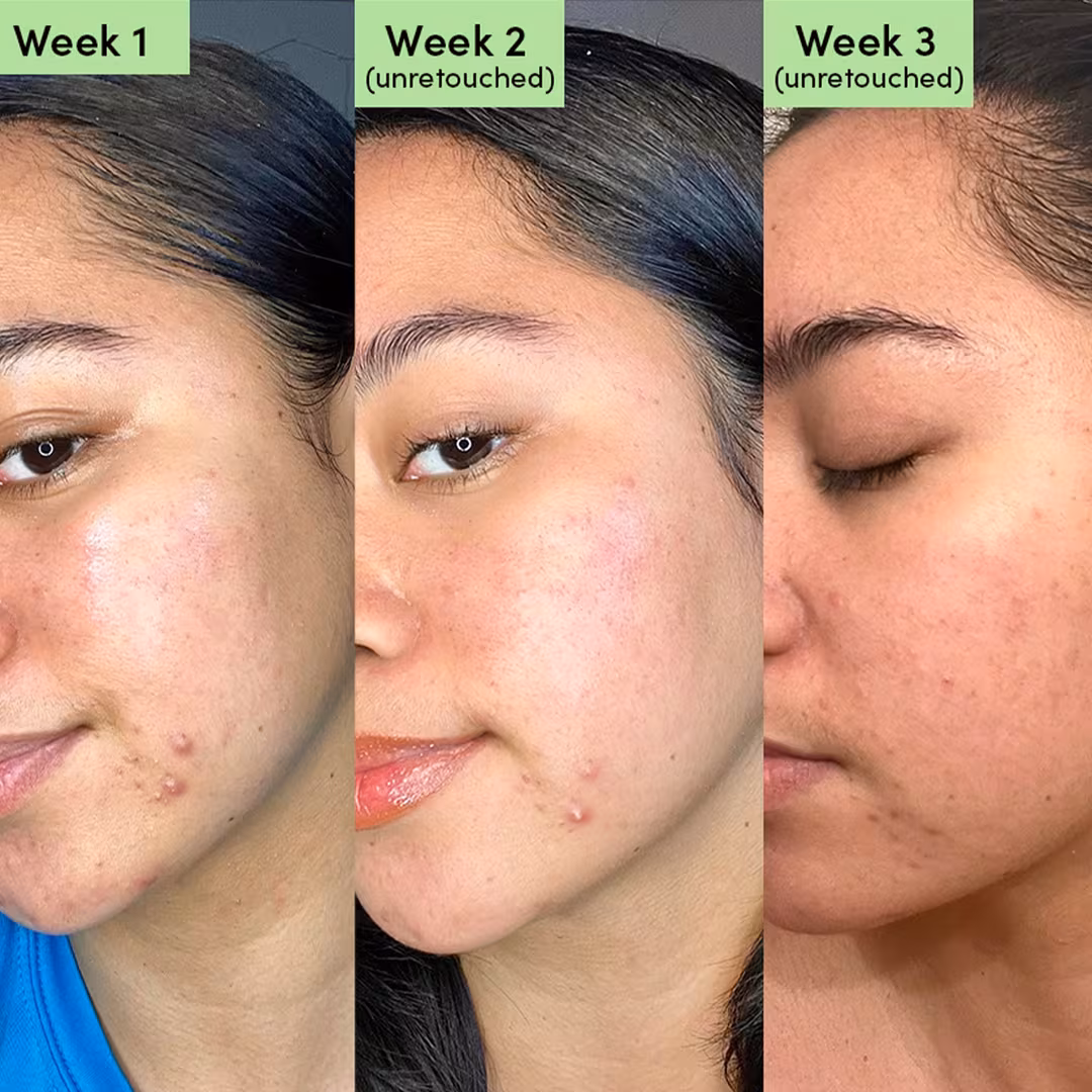 Sand and Sky  Oil Control Clearing Face Mask