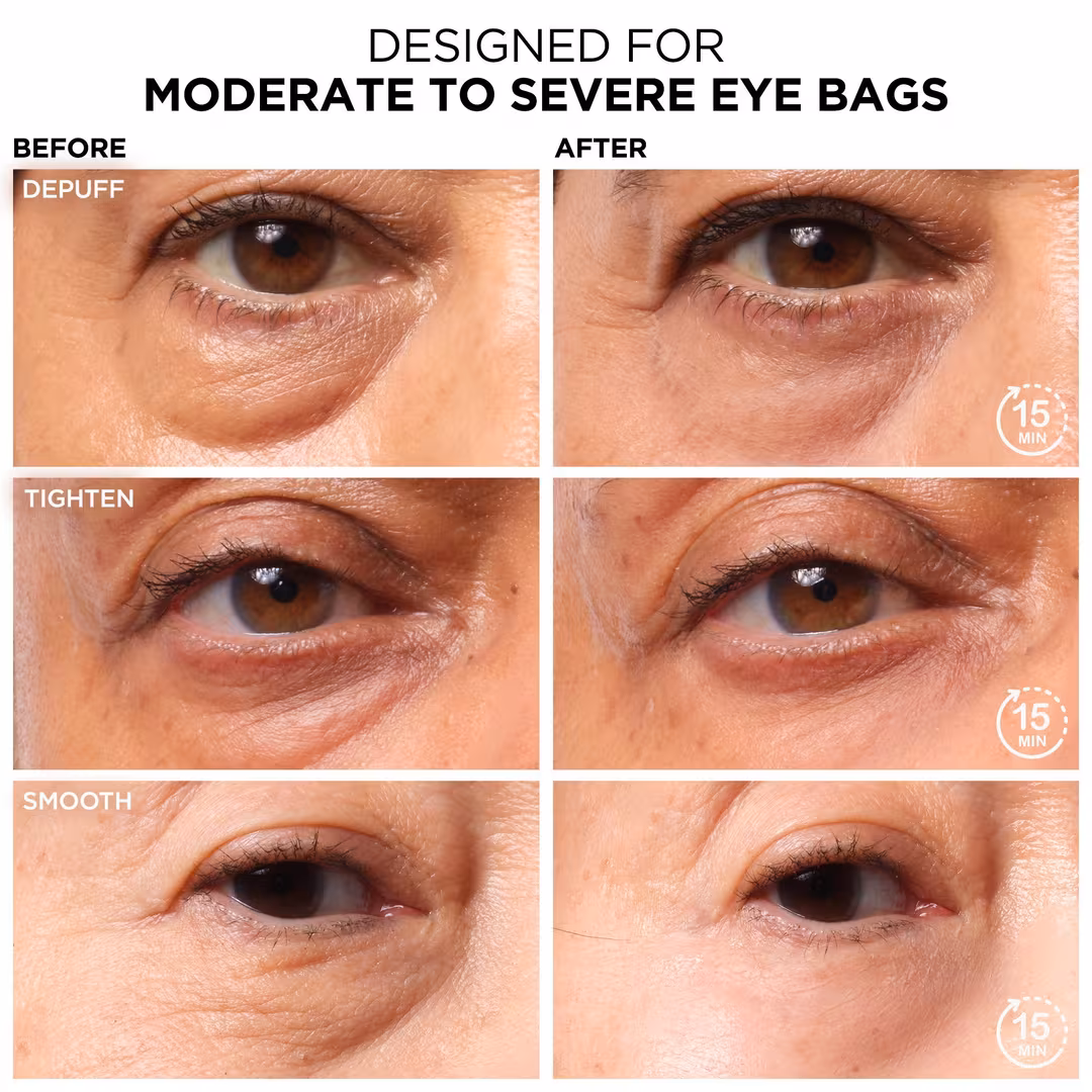 IT Cosmetics  Bye Bye Under Eye Bags Daytime Treatment