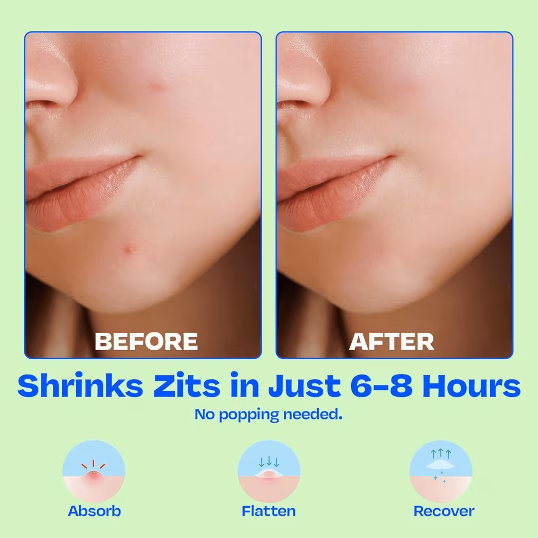 JB Skrub  Clear Pimple Patches Set for Tweens and Teens