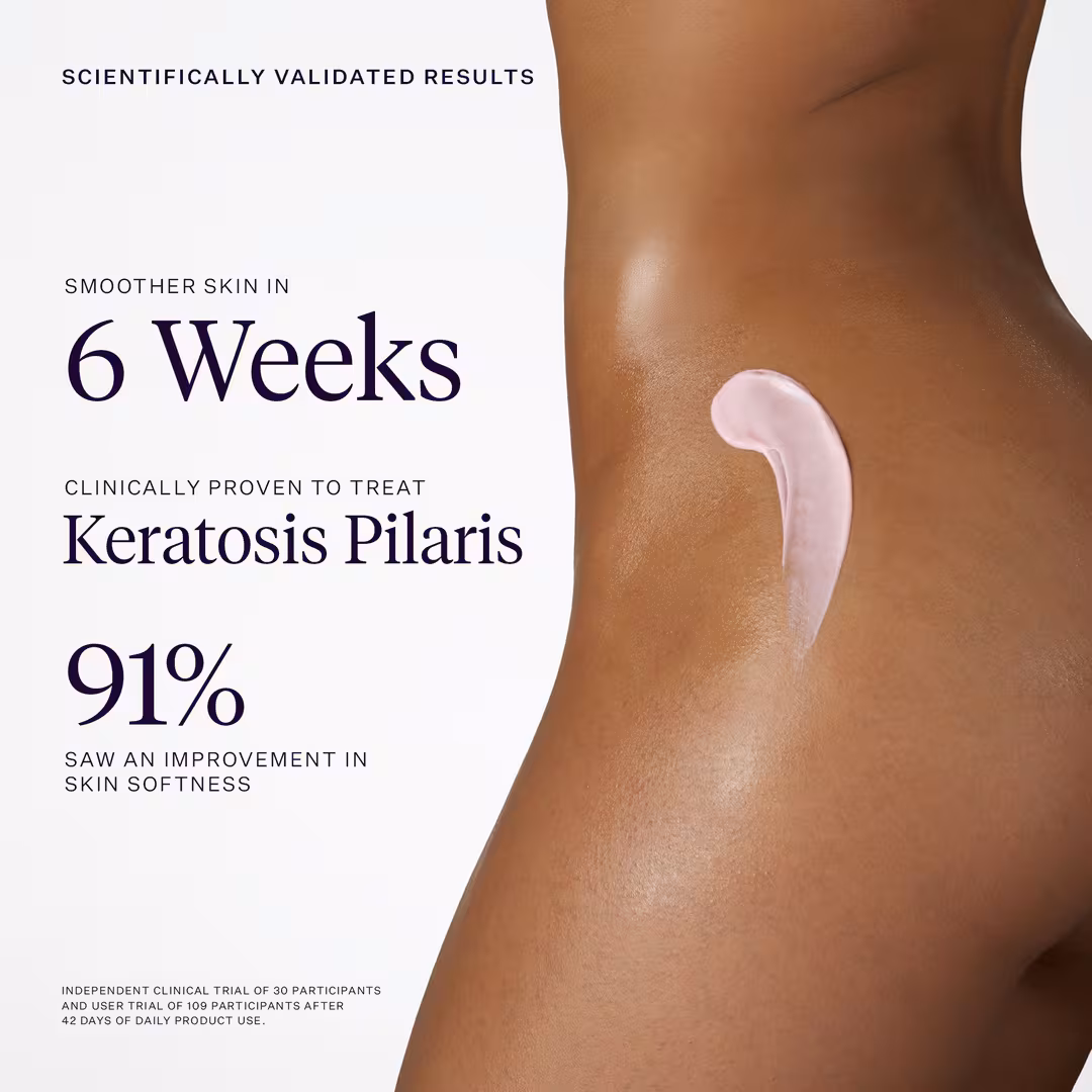 Joonbyrd  Kaleidoscope AHA Smoothing Body Serum - Keratosis Pilaris & Strawberry Legs
