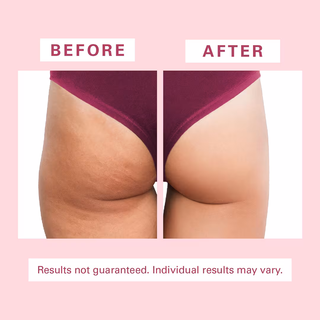 M3  Cellulite Silicon Body Brush