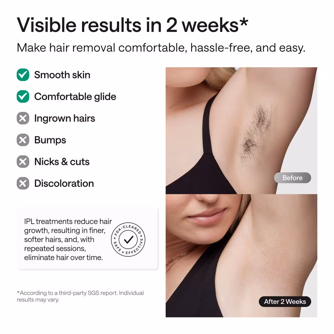 Ulike  Swift 5 Ice Cooling IPL Hair Removal Device