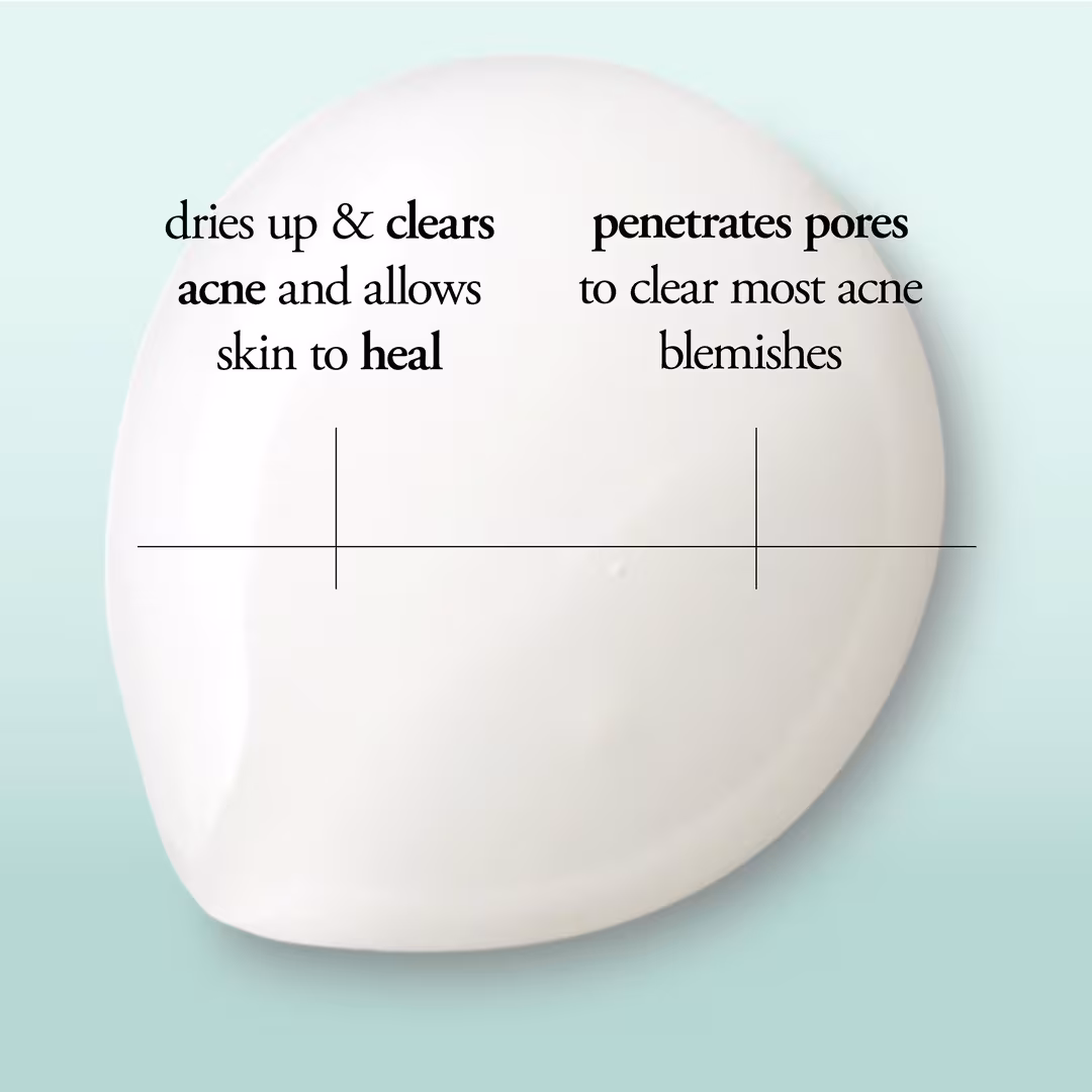 Philosophy  Clear Days Ahead Fast-Acting Salicylic Acid Acne Spot Treatment