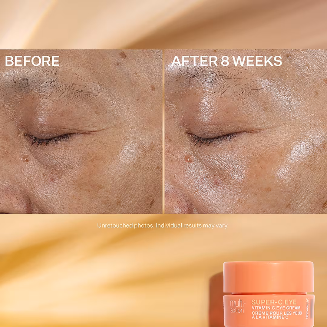 StriVectin  Multi-Action Trio Kit