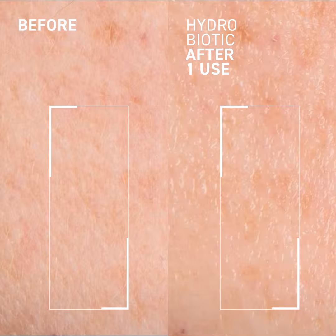 Dr. Brandt  Hydro Biotic