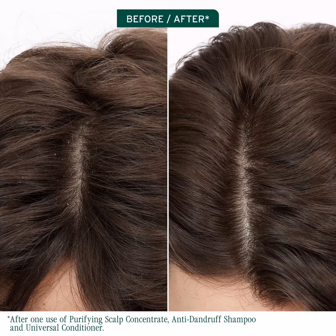 Biolage  Scalp Sync Anti-Dandruff Shampoo