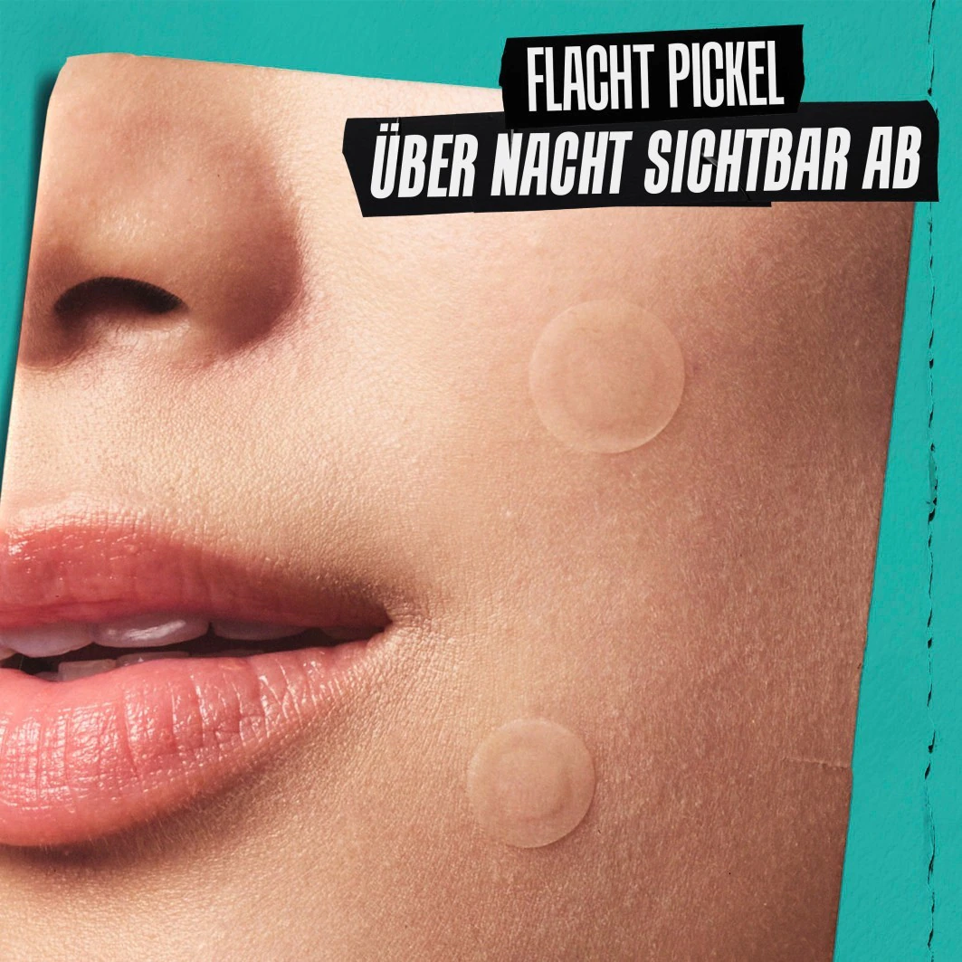 Truly Targeted Overnight Blemish Patches