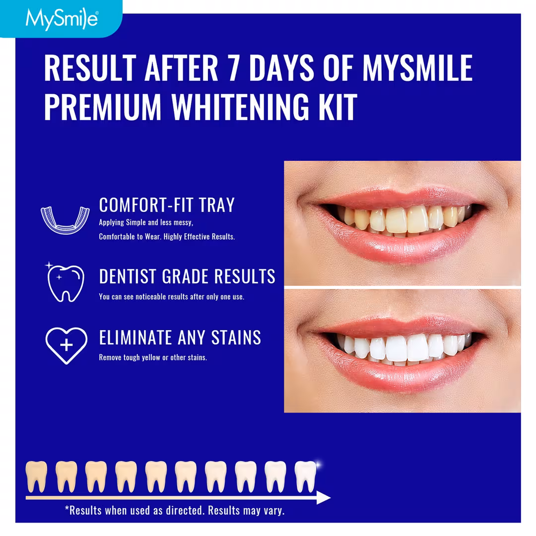MySmile  Prefilled Teeth Whitening Trays Kit, 12% Hydrogen Peroxide