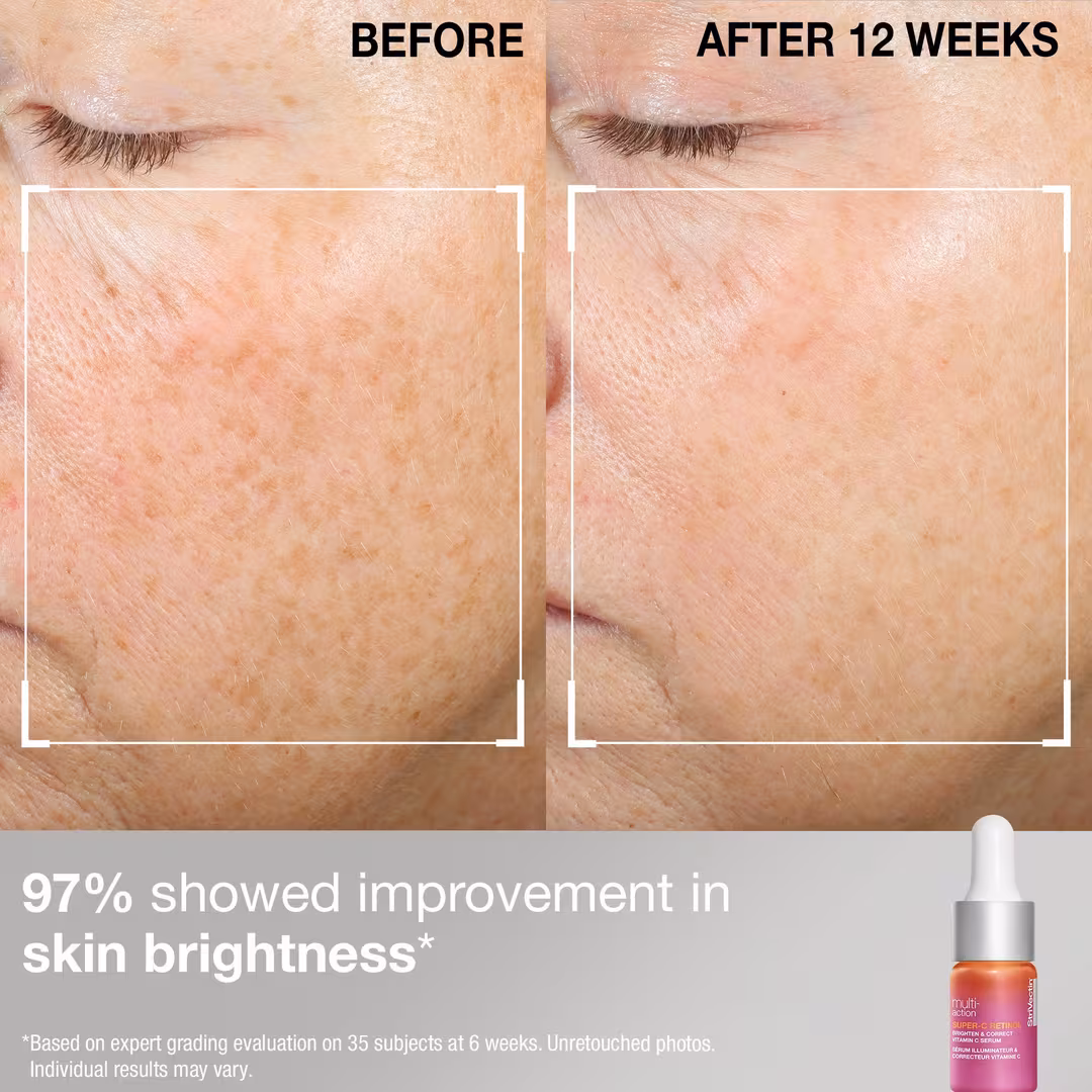 StriVectin  StriVectin Super-C Discovery Series Duo Kit