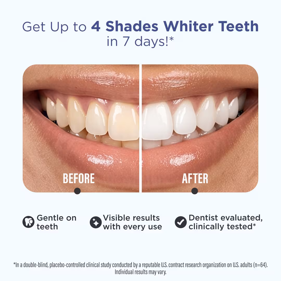 GuruNanda  Whitening Strips - 7 Day Treatment