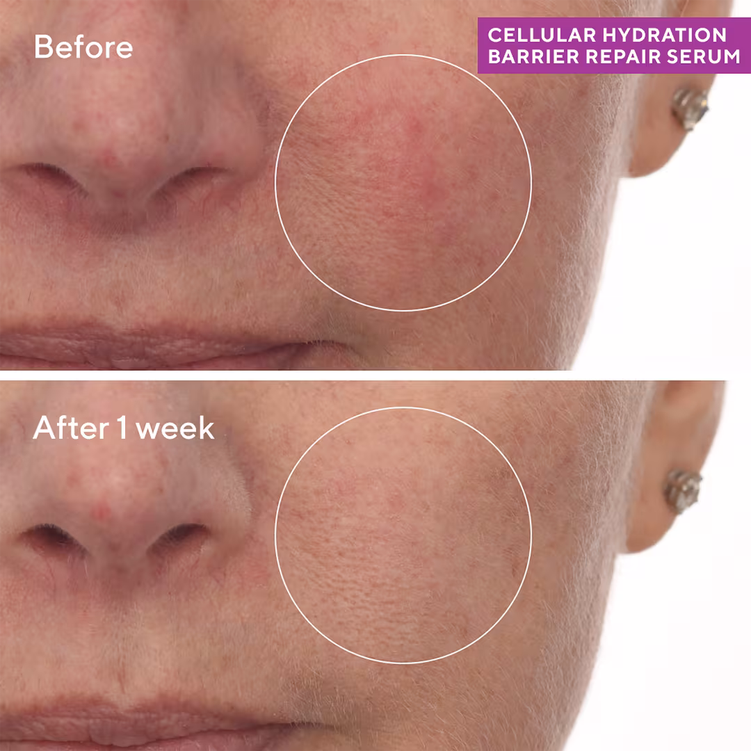Murad  Cellular Hydration Barrier Repair Serum