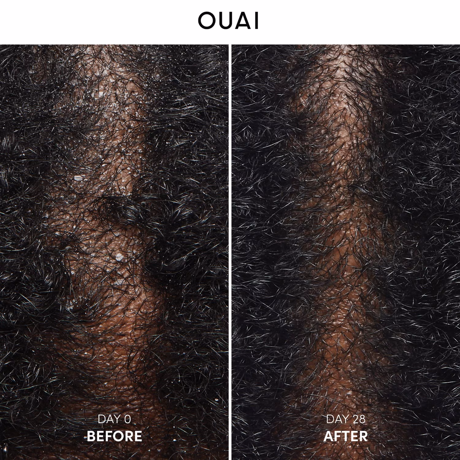 Anti-Dandruff
