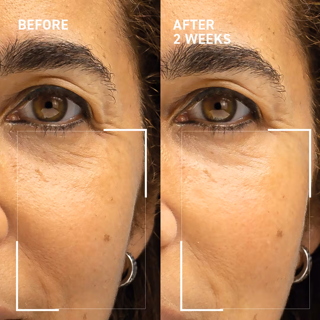 Dr. Brandt  Microneedling Rejuvenating Kit
