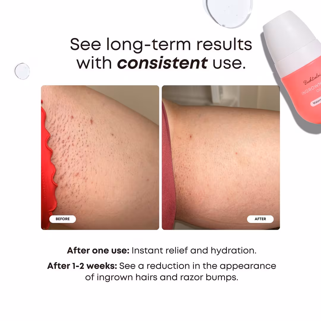 Bushbalm  Mini Ingrown Hair Oil