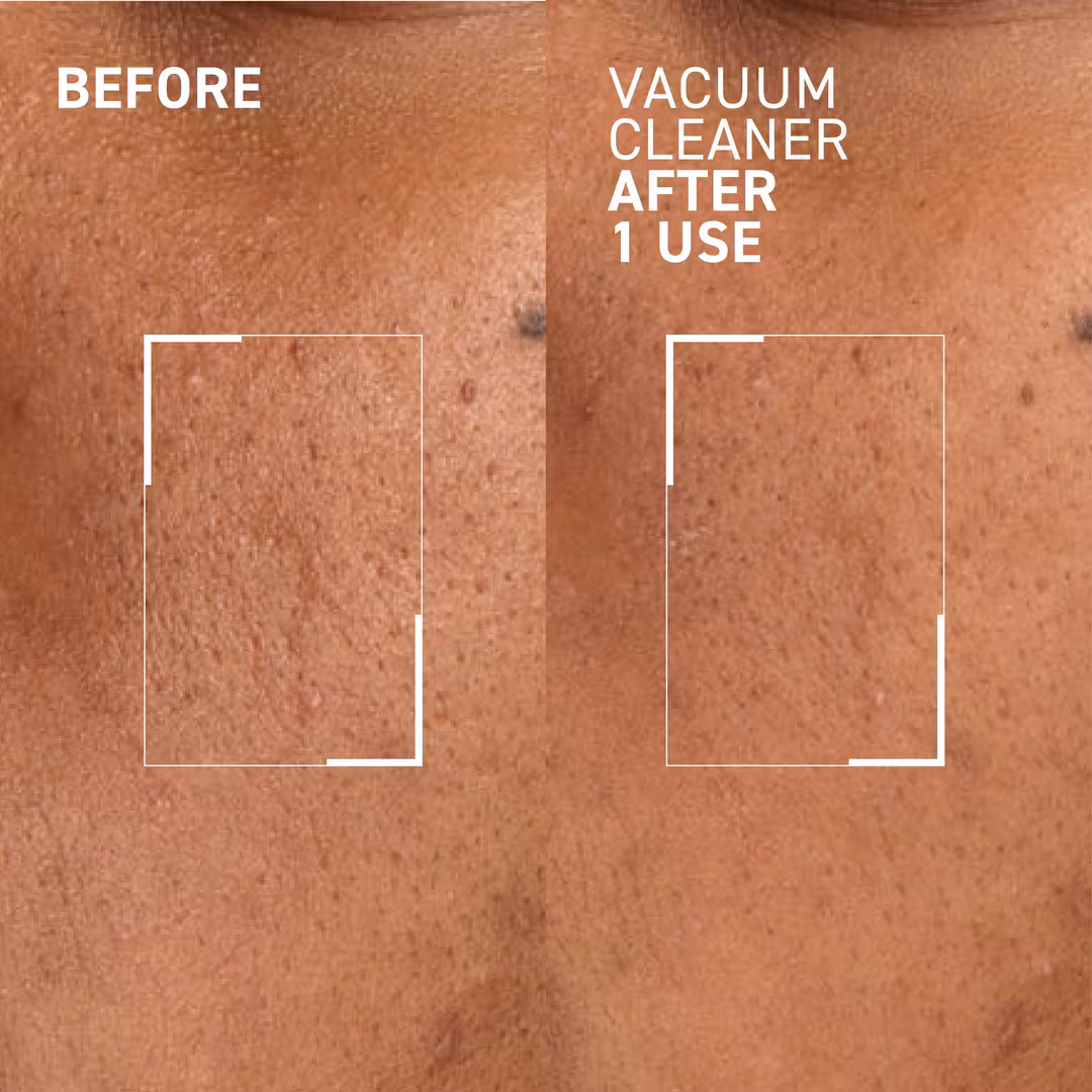 Dr. Brandt  Vacuum Cleaner