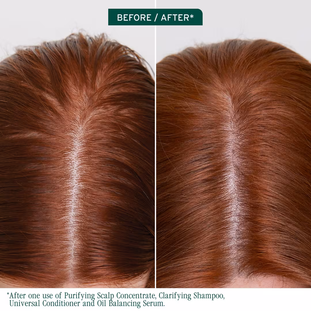 Biolage  Scalp Sync Oil Balancing Serum for All Scalp Types