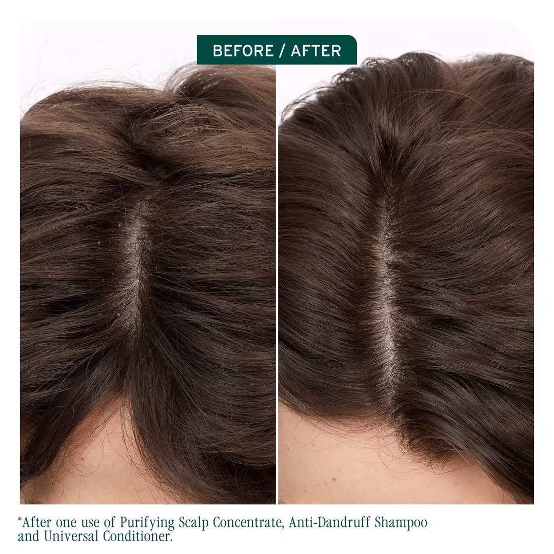 Biolage  Scalp Sync Purifying Concentrate for All Scalp Types