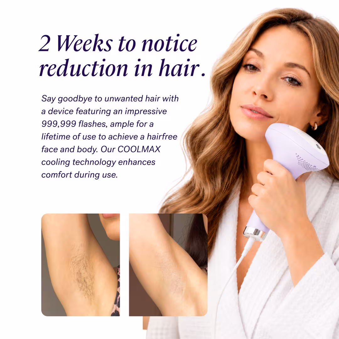 Michael Todd Beauty  Lumos IPL FDA-cleared ice cooling hair removal device with 999,999 flashes