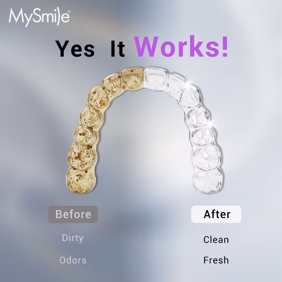 MySmile  MS202B Cordless Ultrasonic Retainer & Jewelry Cleaning Pod with Digital Timer