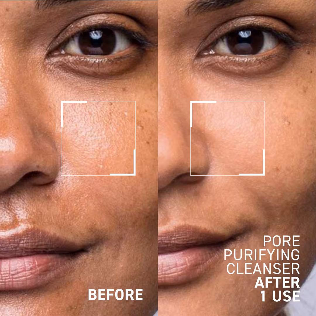Dr. Brandt  Pore Purifying Cleanser