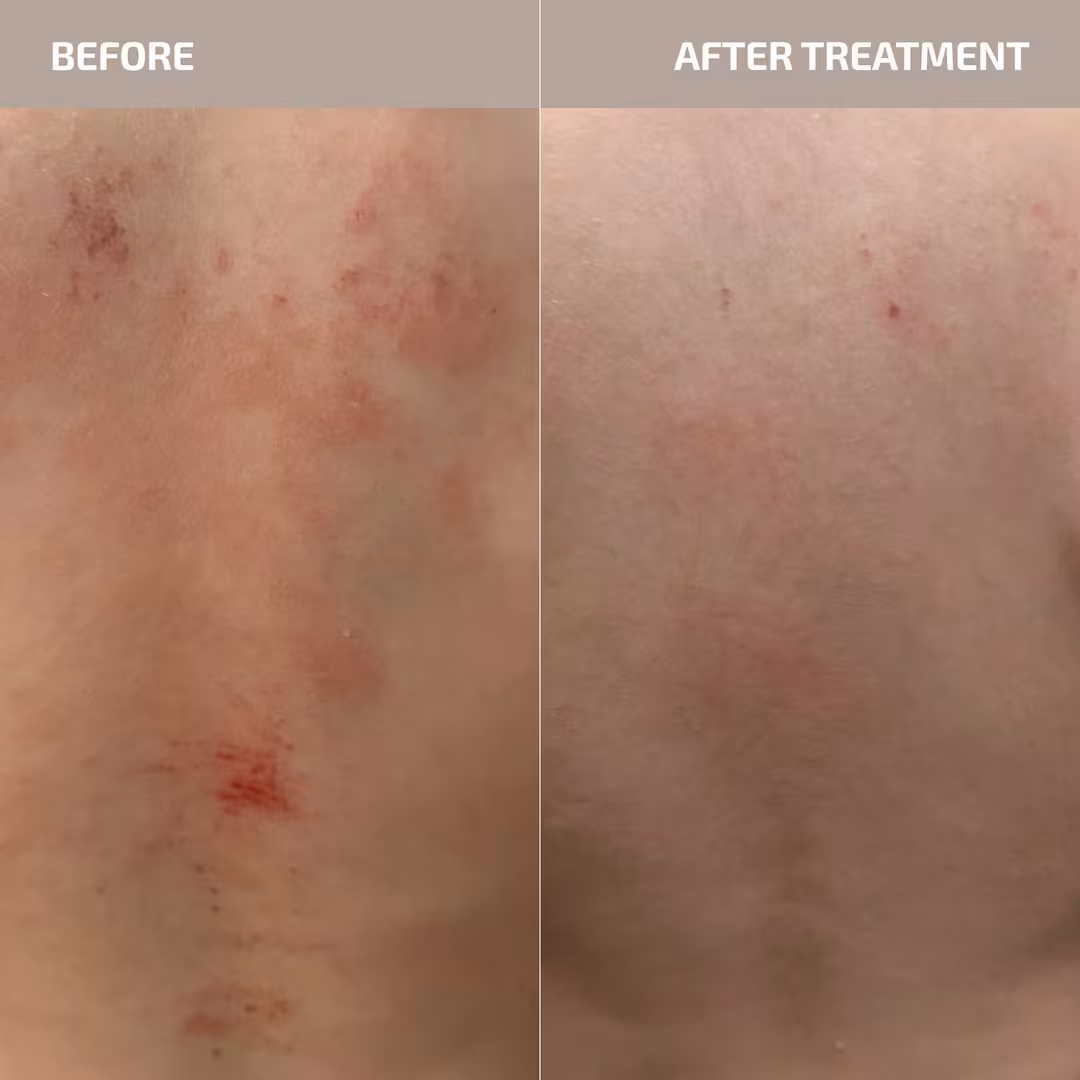 Codex Labs  ANTÜ Skin Barrier Support Supplement