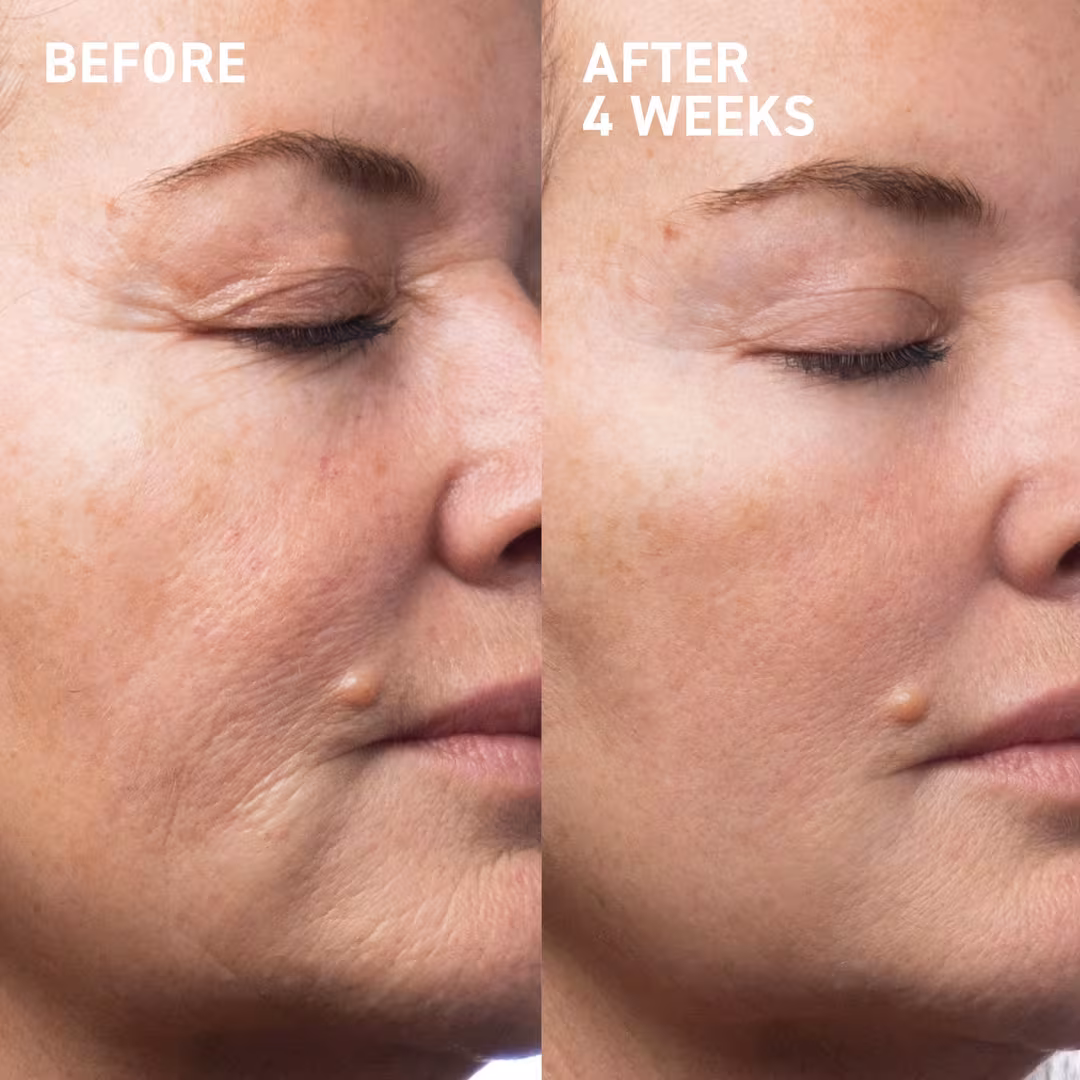Dr. Brandt  Wrinkle Free Duo