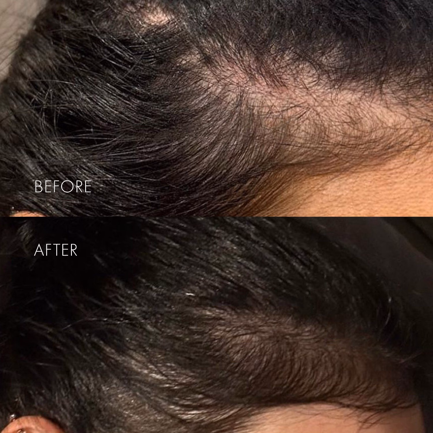 The Hair Serum
