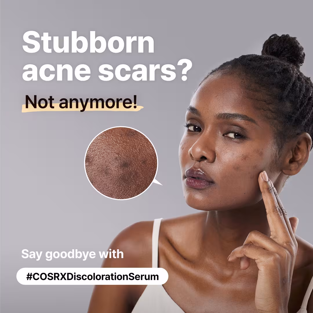COSRX  The Alpha-Arbutin 2 Discoloration Care Serum