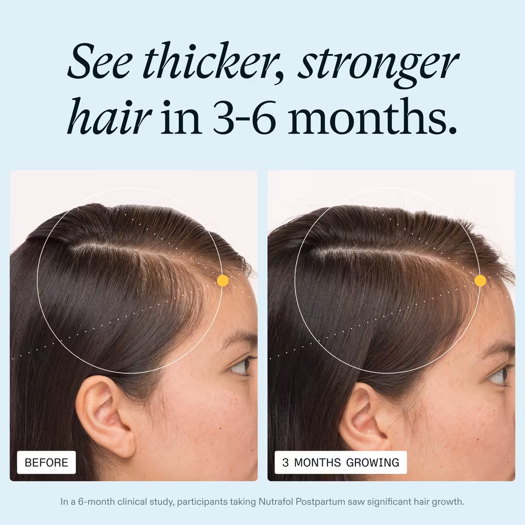 NUTRAFOL  Postpartum OBGYN-Formulated Hair Growth Supplement