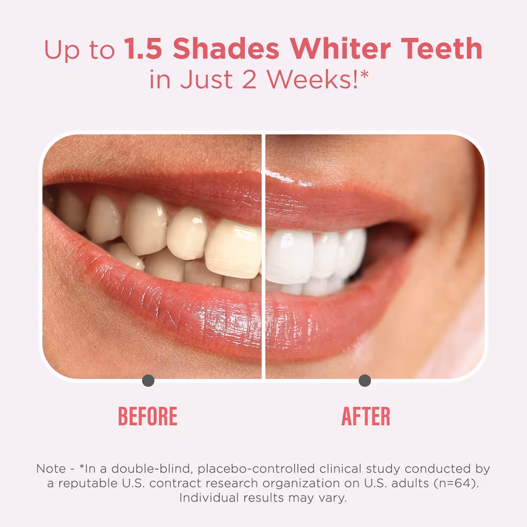 GuruNanda  Sensitive Whitening Strips