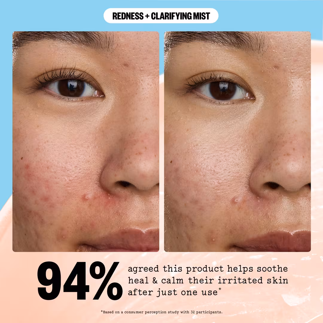 Peace Out  Redness Reducing + Clarifying Facial Mist