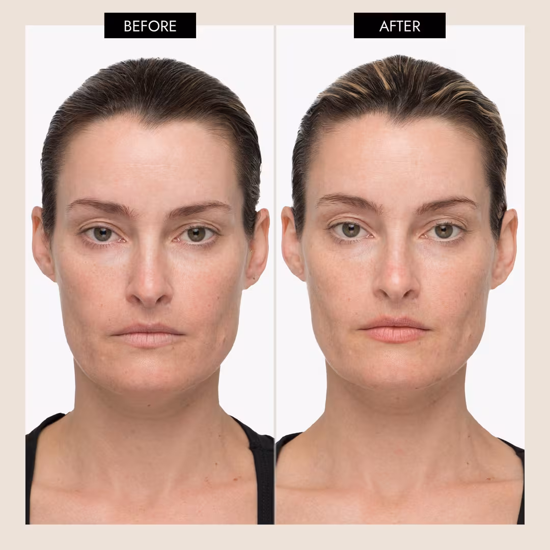 7 E Wellness  QT Plus Smart Microcurrent Facial Toning Device