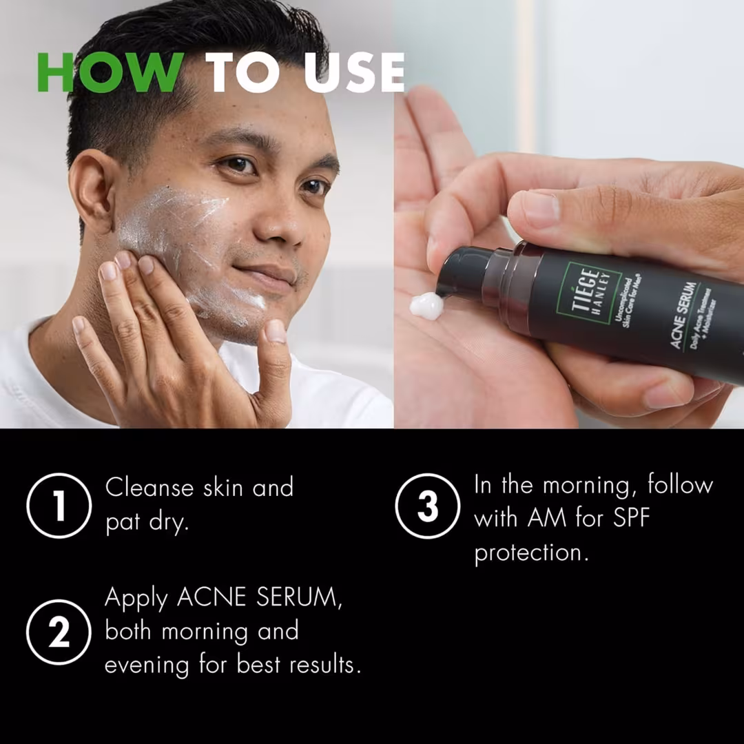 Tiege Hanley  ACNE SERUM Daily Acne Treatment & Moisturizer