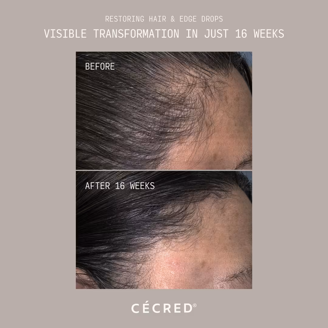 CÉCRED  Restoring Hair & Edge Drops XL