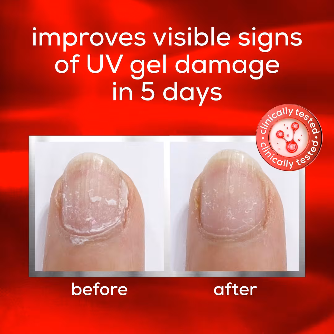 Essie  To The Rescue UV Gel Damage Repair