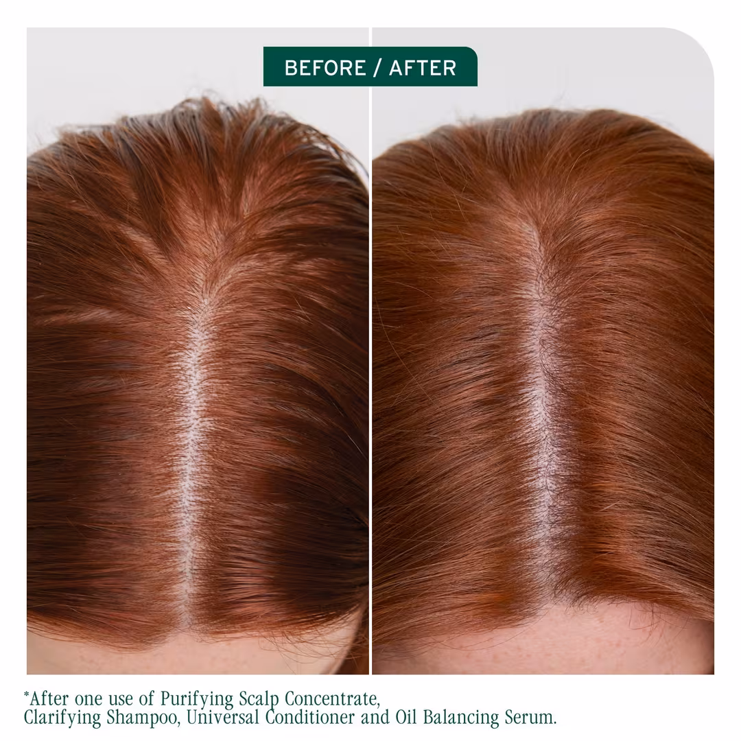 Biolage  Scalp Sync Clarifying Shampoo for Oily Scalp