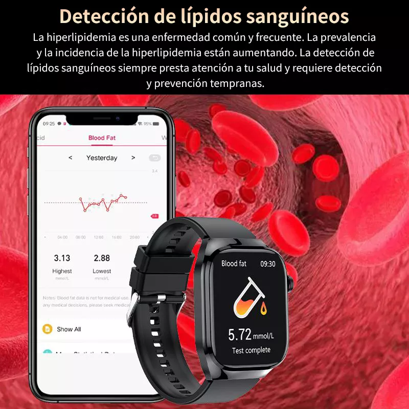 Reloj Inteligente Mujer Presión Arterial Y Azúcar En Sangre