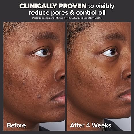 Paulas Choice--SKIN PERFECTING 2% BHA Liquid Salicylic Acid Exfoliant--Facial Exfoliant for Blackheads, Enlarged Pores, Wrinkles & Fine Lines, 4 oz Bottle - Verve BeautyPaulas Choice--SKIN PERFECTING 2% BHA Liquid Salicylic Acid Exfoliant--Facial Exfoliant for Blackheads, Enlarged Pores, Wrinkles & Fine Lines, 4 oz Bottle$32.00Paula's Choice 液体水杨酸去角质剂