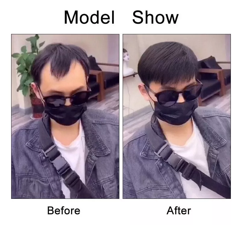 Nuevo 4 X16cm Sistema Capilar Frontal De Cabello Natural